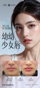 美莱幼幼少女唇——武汉美莱气质微整中心