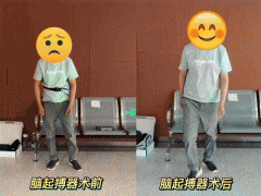 湖北首例！同济医院为帕金森病患者植入全球首个具有大脑感知功能的方向性电